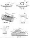 Fig. 02 - ANEURYSM TREATMENT DEVICES