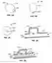 Fig. 04 - ANEURYSM TREATMENT DEVICES