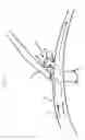 Fig. 02 - FLEXIBLE VASCULAR OCCLUDING DEVICE
