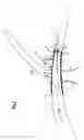 Fig. 07 - FLEXIBLE VASCULAR OCCLUDING DEVICE