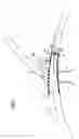 Fig. 07 - Flexible vascular occluding device