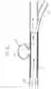 Fig. 08 - Flexible vascular occluding device