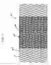 Fig. 11 - Flexible vascular occluding device