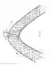 Fig. 13 - Flexible vascular occluding device