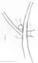 Fig. 15 - Flexible vascular occluding device