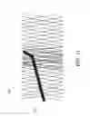 Fig. 17 - Flexible vascular occluding device
