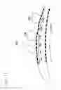 Fig. 18 - Flexible vascular occluding device