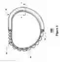 Fig. 02 - Valvular support prosthesis