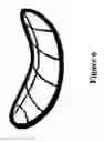 Fig. 07 - Valvular support prosthesis