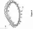 Fig. 09 - Valvular support prosthesis