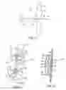 Fig. 08 - Intraocular telescope
