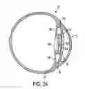 Fig. 09 - Intraocular telescope