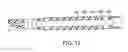 Fig. 09 - Facilitating drainage