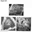 Fig. 16 - Custom-made meganuclease and use thereof