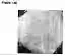 Fig. 17 - Custom-made meganuclease and use thereof