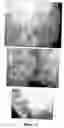 Fig. 18 - Custom-made meganuclease and use thereof