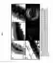 Fig. 08 - Cellulose synthase promoter and method for modifying cellulose and lignin biosynthesis in plants