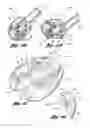 Fig. 09 - Bath apparatus with handle and auxiliary features