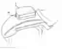 Fig. 01 - Comfort pad for vehicles