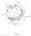 Fig. 05 - Efficient, hand-held matter removal systems