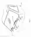 Fig. 02 - Ball and socket joint utilizing a single ball, for driving more than one driven member