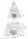 Fig. 06 - Leg support apparatus for trees and bushes