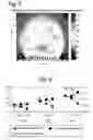 Fig. 05 - Method for treating the surface of a machine element