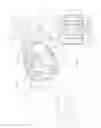 Fig. 02 - Ammunition for electrical discharge weapon