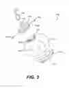 Fig. 04 - Bird feeder