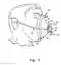 Fig. 03 - Face mask strap system