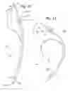 Fig. 12 - Intubation device and method of use