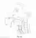 Fig. 13 - Intubation device and method of use
