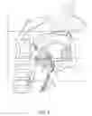 Fig. 02 - Tissue anchoring system for percutaneous glossoplasty