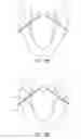 Fig. 07 - Tissue anchoring system for percutaneous glossoplasty