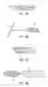 Fig. 15 - Tissue anchoring system for percutaneous glossoplasty