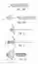 Fig. 16 - Tissue anchoring system for percutaneous glossoplasty
