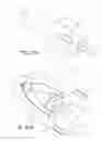 Fig. 24 - Tissue anchoring system for percutaneous glossoplasty
