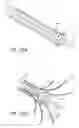 Fig. 25 - Tissue anchoring system for percutaneous glossoplasty