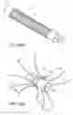 Fig. 26 - Tissue anchoring system for percutaneous glossoplasty
