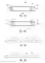 Fig. 30 - Tissue anchoring system for percutaneous glossoplasty