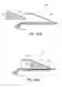 Fig. 41 - Tissue anchoring system for percutaneous glossoplasty