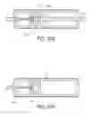 Fig. 44 - Tissue anchoring system for percutaneous glossoplasty