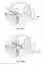 Fig. 55 - Tissue anchoring system for percutaneous glossoplasty