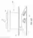 Fig. 65 - Tissue anchoring system for percutaneous glossoplasty