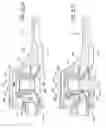 Fig. 66 - Tissue anchoring system for percutaneous glossoplasty