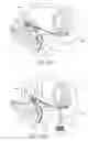 Fig. 67 - Tissue anchoring system for percutaneous glossoplasty