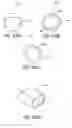 Fig. 72 - Tissue anchoring system for percutaneous glossoplasty
