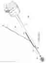 Fig. 82 - Tissue anchoring system for percutaneous glossoplasty
