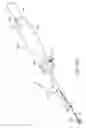 Fig. 83 - Tissue anchoring system for percutaneous glossoplasty