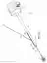 Fig. 84 - Tissue anchoring system for percutaneous glossoplasty